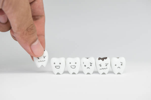 歯科医の手に虫歯歯科医療概念モデルの設定 - 歯痛 写真 ストックフォトと画像