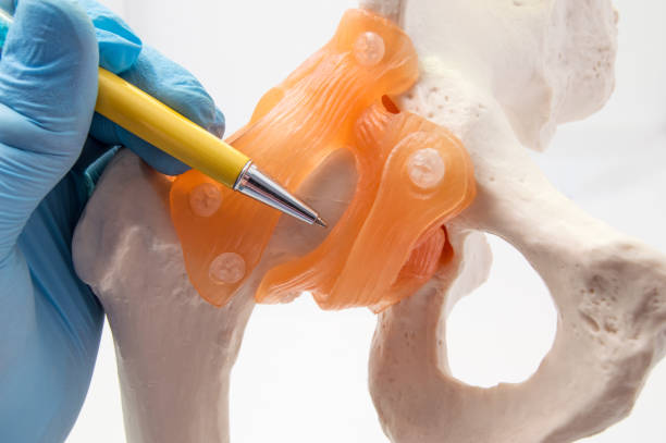 hip joint and bone anatomy concept photo. doctor points to anatomy model of hip joint and pelvis bone with ligaments where localized diseases such as dysplasia, fracture, osteoarthritis or replacement - osteoarthritis doctor medicine healthcare and medicine imagens e fotografias de stock