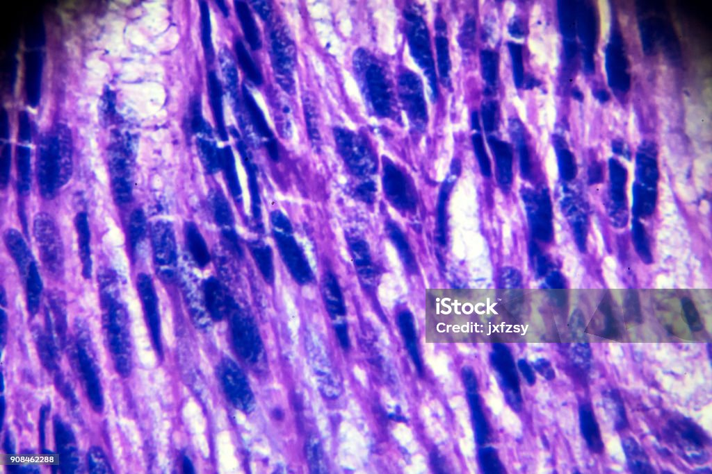 Leiomyoma (uterus) biopsy sample under light microscopy Leiomyoma (uterus) biopsy sample under light microscopy zoom in different regions Biological Cell Stock Photo