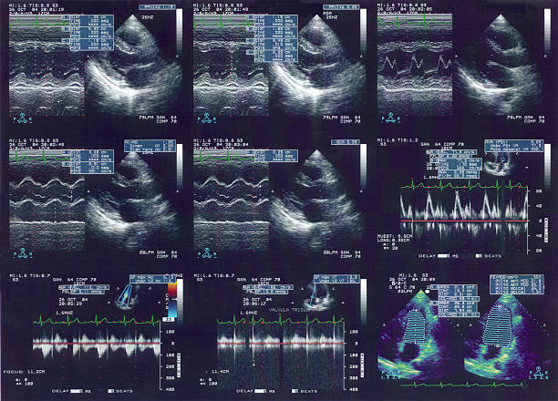 Echo Cardiogram  medical scan photos stock pictures, royalty-free photos & images