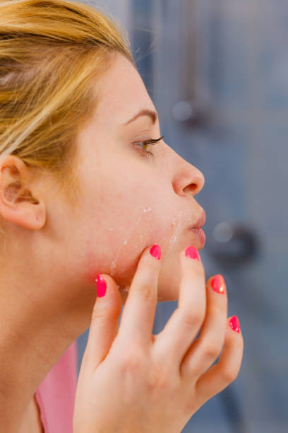 woman removing peel off mask from her face - dry aged imagens e fotografias de stock