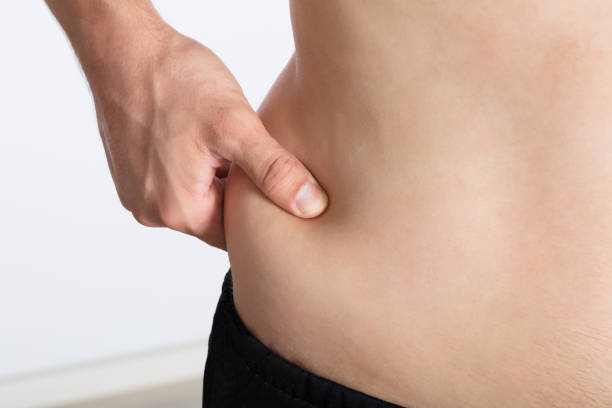 istock Woman Pinching Excessive Stomach Fat 908765008