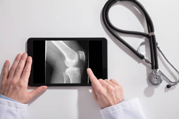istock Doctor's Hand And Digital Tablet Screen Showing Knee X-ray 908800874