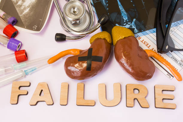 Kidney or adrenal failure concept photo. Kidney with glued black cross is near word failure and set of medical tests (MRI, ultrasound, analysis), diagnostic devices (stethoscope, test tubes, syringes) foto de concepto de insuficiencia renal o suprarrenal. riñón con negro pegado cruz está junto a la falta de palabra y un conjunto de exámenes médicos (resonancia magnética, ultrasonido, análisis), dispositivos de diagnóstico (estetoscopio, jeringas y tubos de ensayo)