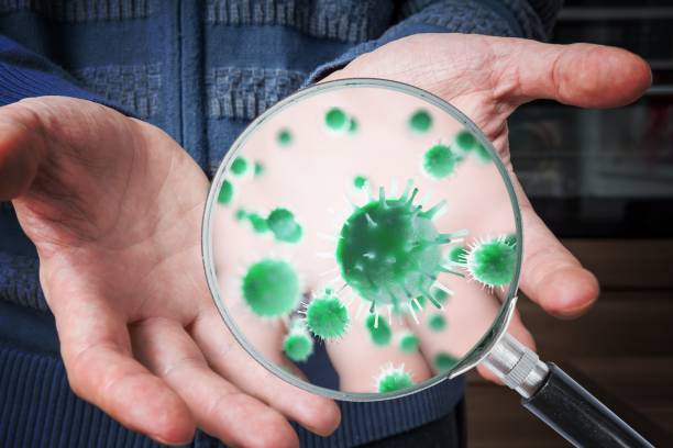 Hygiene concept. Man is showing dirty hands with many viruses and germs. stock photo