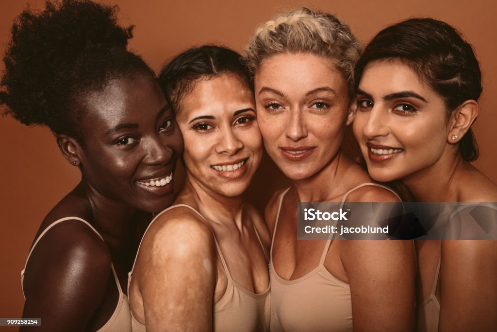 Beautiful woman with different skin types Portrait of four young women with different skin types. Diverse group of females standing together and looking at camera. Vitiligo Stock Photo