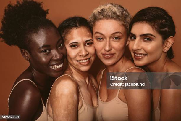 Beautiful Woman With Different Skin Types Stock Photo - Download Image Now - Vitiligo, Human Face, Beauty