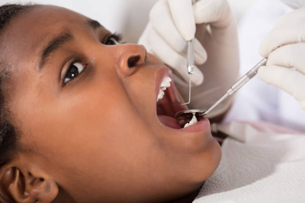 istock African Girl With Mouth Open During Oral Checkup 909310034