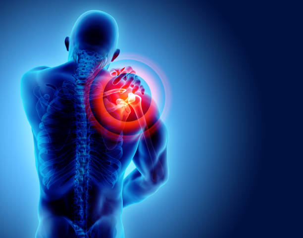 istock Shoulder painful skeleton x-ray, 3D illustration. 909934852