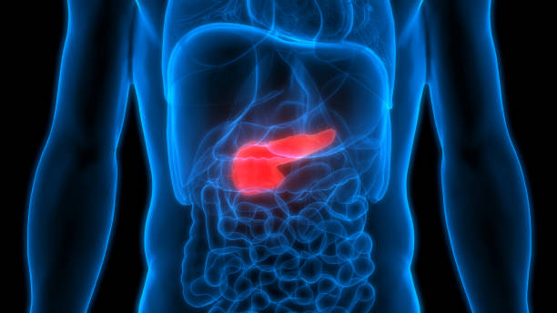 anatomía de los órganos del cuerpo humano (páncreas) - cáncer tumor ilustraciones fotografías e imágenes de stock