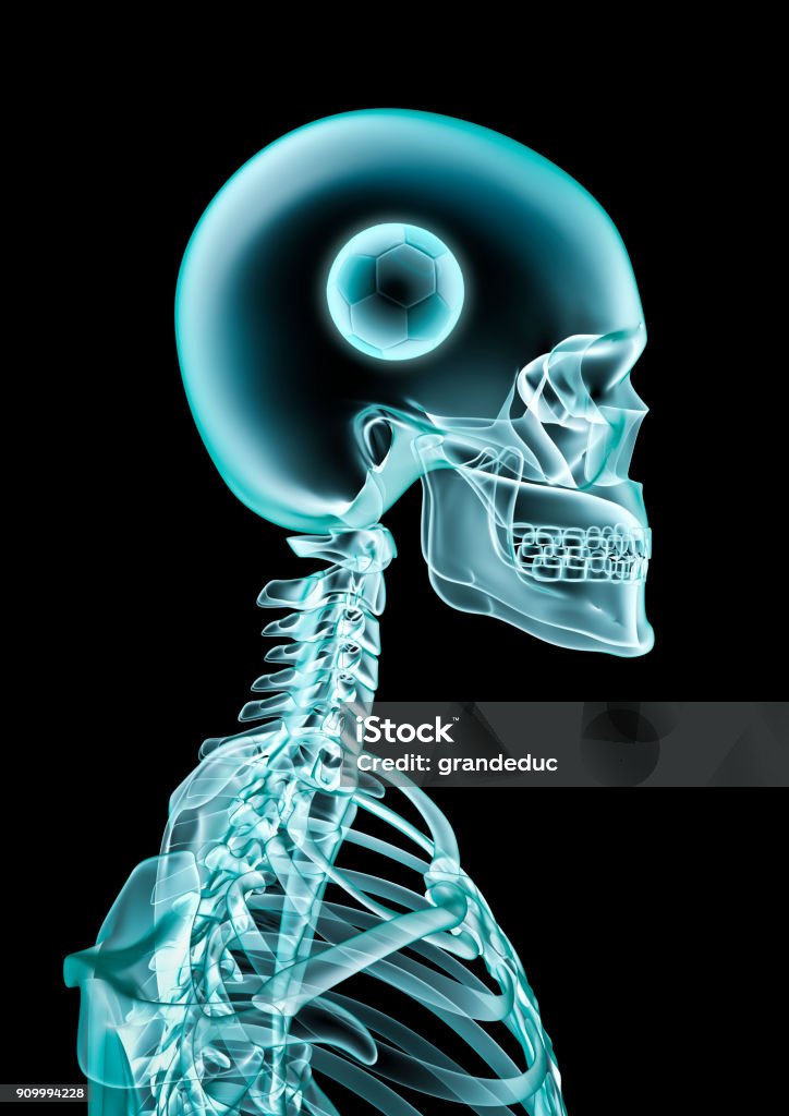 Xray Soccer Fan Stock Photo - Download Image Now - Soccer, Soccer Ball ...
