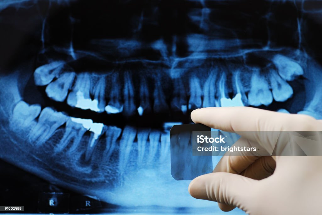 Radiografía Dental - Foto de stock de Agarrar libre de derechos
