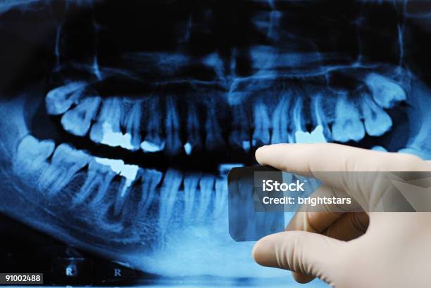 Dentale - Fotografie stock e altre immagini di Ambulatorio dentistico - Ambulatorio dentistico, Apparecchiatura odontoiatrica, Bocca umana