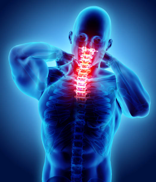 istock Neck painful - cervical spine skeleton x-ray, 3D illustration. 910189144