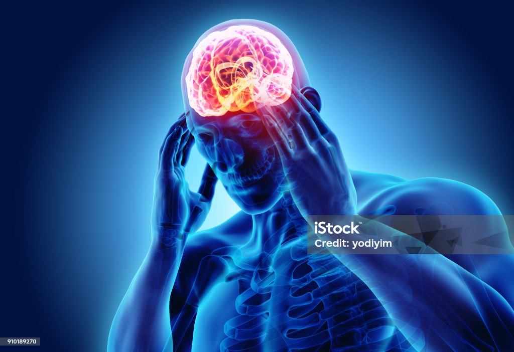 3d illustration of headache human. 3d illustration of headache human, x-ray medical concept. Headache Stock Photo