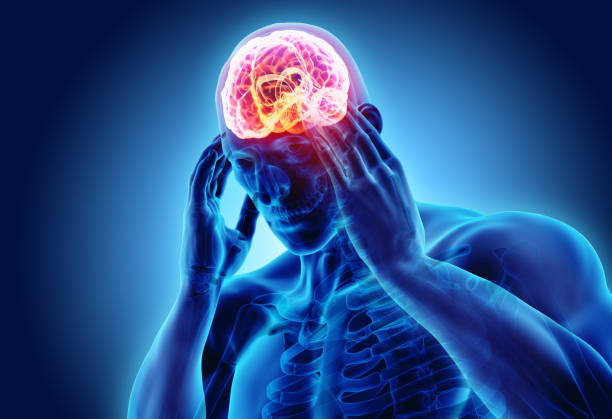 3d illustration of headache human. stock photo