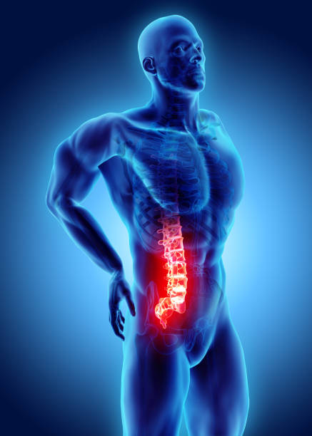 istock 3D Illustration of sacral spine painful. 910189388