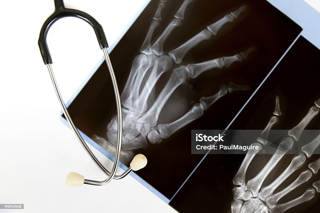 X-ray et stéthoscope - Photo de Anatomie libre de droits