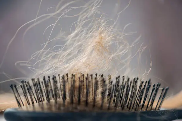 Illustrating an idea on Alopecia. The first signs of hair loss can be hair accumulating in your hair brush. This can be bought on by a number of conditions including the side effects of medical treatment or an auto immune deficiency that can trigger early onset Alopecia or baldness.