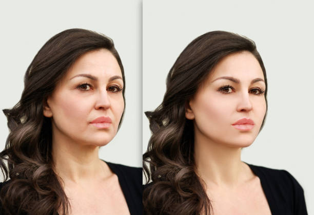istock Aging. Mature woman-young woman. 910624072