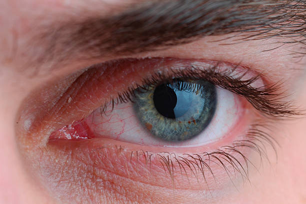 istock Close up of tired blue green eye. 91090932