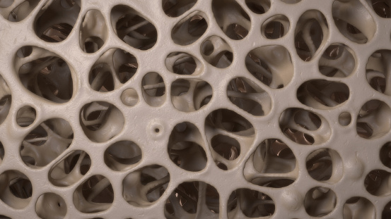 CG 3D prestados imagen de osteoporosis hueso micro estructura photo