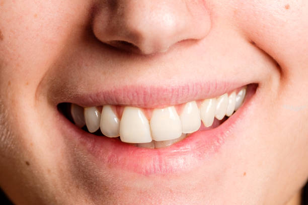 istock woman mouth smiling 911119272