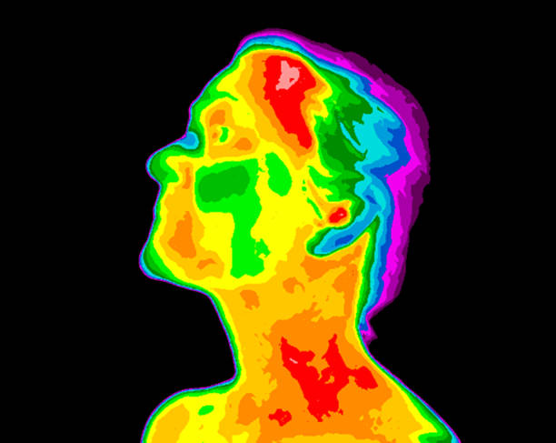 istock Face Thermography Carotid Inflammation 911128562