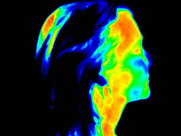 istock Right side of Face Thermography 911128568