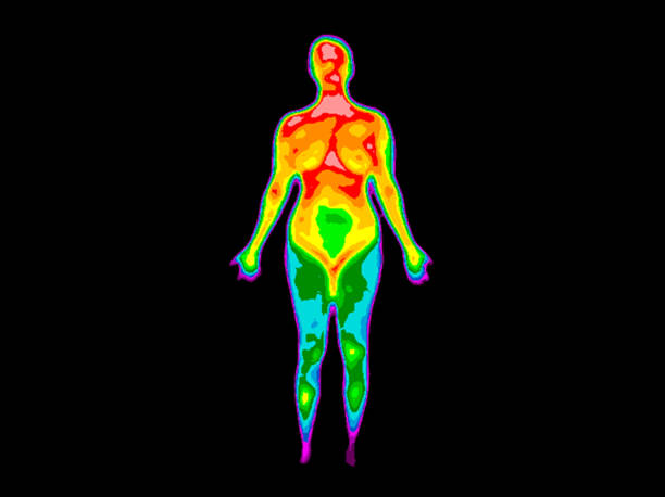 Thermography Whole Body Front 2b Photo of thermographic image of front of whole body of a woman with photo showing different temperatures in a range of colors from blue showing cold to red showing hot which can indicate joint inflammation. inflammation photos stock pictures, royalty-free photos & images