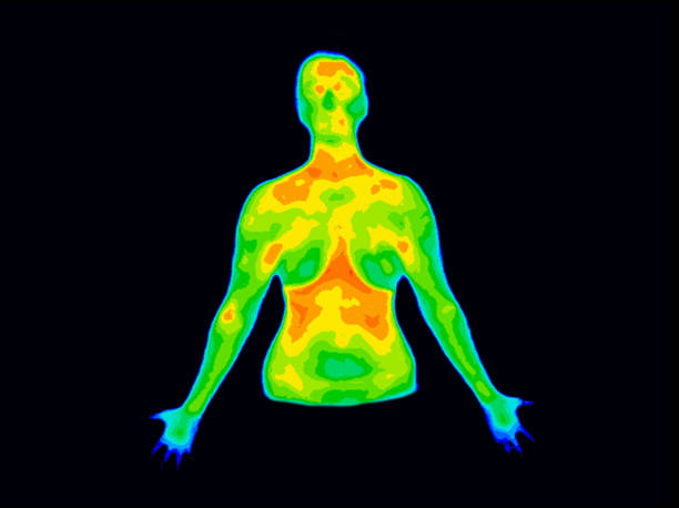 Thermography Front Upper body b Photo of thermographic image of front of upper body of a woman with photo showing different temperature in range of colors from blue showing cold to red showing hot which can indicate joint inflammation. thermal image stock pictures, royalty-free photos & images
