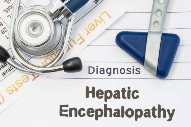 130+ Hepatic Encephalopathy Stock Photos, Pictures & Royalty-Free ...