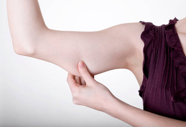 istock hand pinching in upper arm 911500386