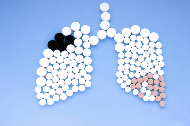 istock Lungs made of different pills on blue background. World Tuberculosis Day concept 911765116
