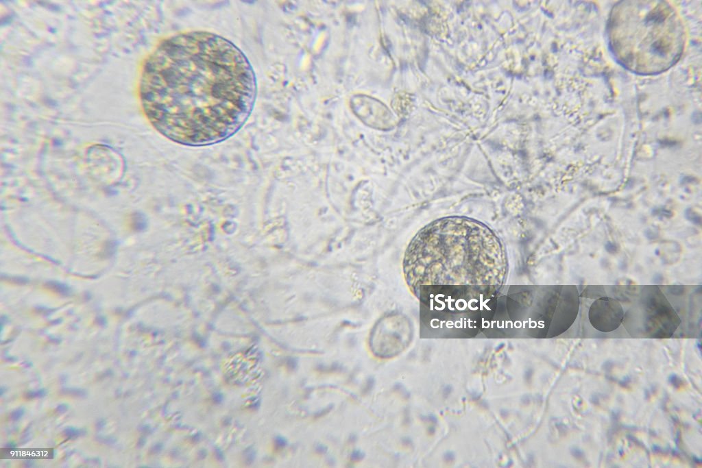 Las algas Chlamydomonas, ciliados paramecium y muchas bacterias a través de microscopio - Foto de stock de Chlamydomonas libre de derechos