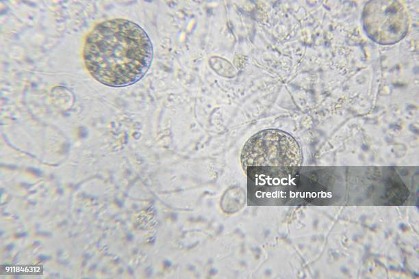 Las Algas Chlamydomonas Ciliados Paramecium Y Muchas Bacterias A Través De Microscopio Foto de stock y más banco de imágenes de Chlamydomonas