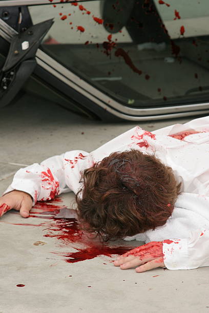 dui 충돌사고 시리즈 - drunk driving accident teenager 뉴스 사진 이미지