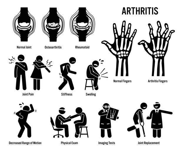 関節炎、関節痛および関節疾患アイコン。 - pain joint human hand arthritis点のイラスト素材／クリップアート素材／マンガ素材／アイコン素材