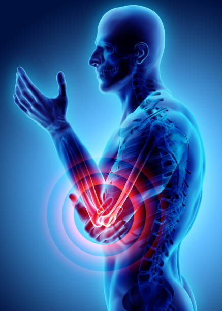 istock 3d illustration of human elbow injury. 912268036