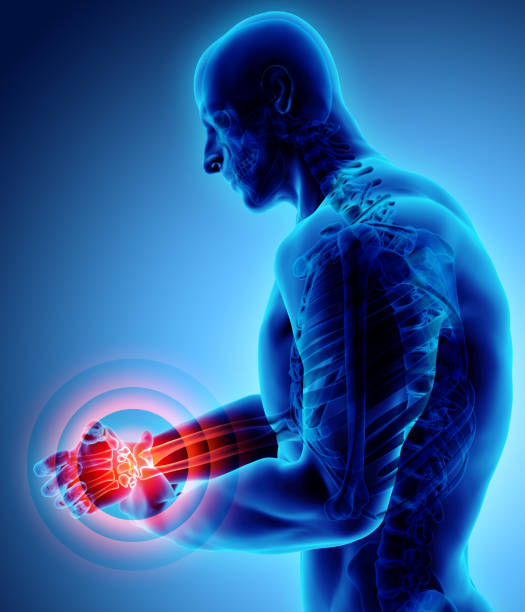 istock Wrist painful - skeleton x-ray. 912268040