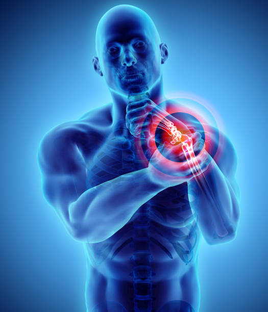 istock Wrist painful - skeleton x-ray. 912268044