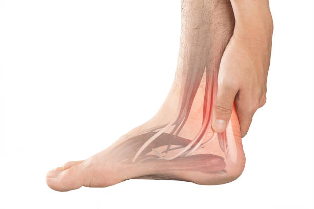 istock heel muscle pain 912430186