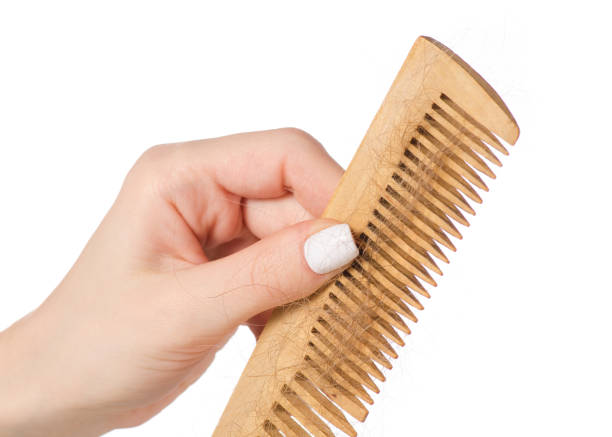 istock Comb with hair in hand 912641298