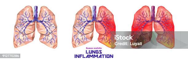 Human Lungs And Trachea Set In Low Poly Healthy One Lung Ill Sick Lungs Vector Stock Illustration - Download Image Now