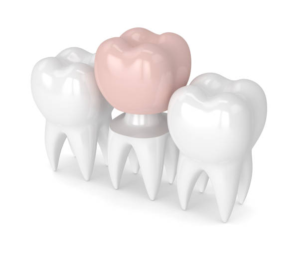 istock 3d render of teeth with dental crown restoration 912855086