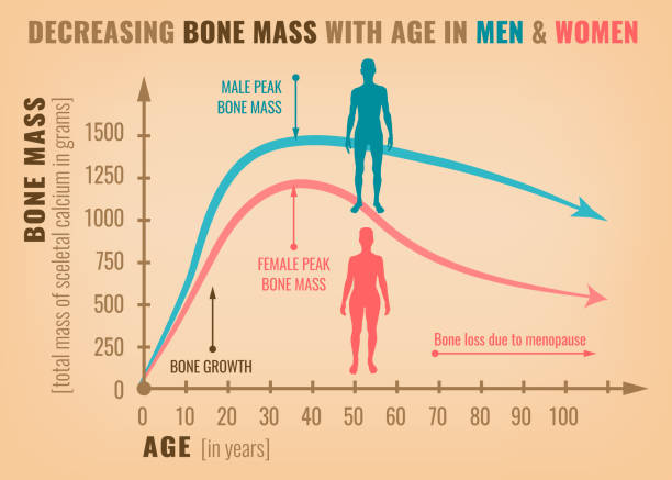 Decreasing bone mass Decreasing bone mass with age in men and women. Detailed infographic in beige, pink and blue colors. Vector illustration. Healthcare and medicine concept. porous sponge stock illustrations