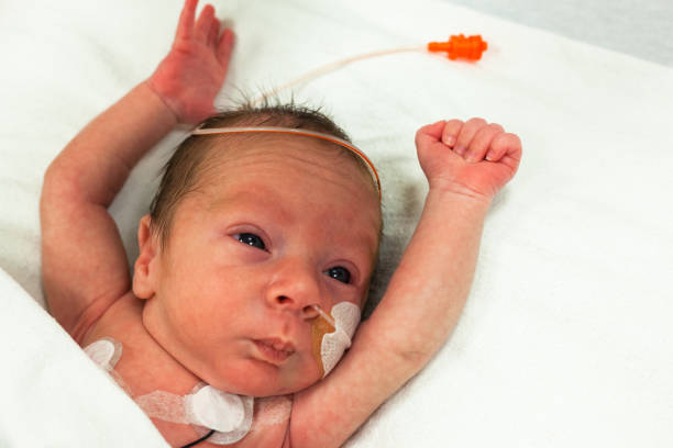 Premature baby in the neonatal intensive care unit with arms raised stock photo