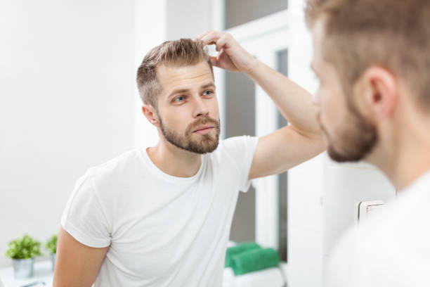 istock Handsome young man worried about hairloss 913434664