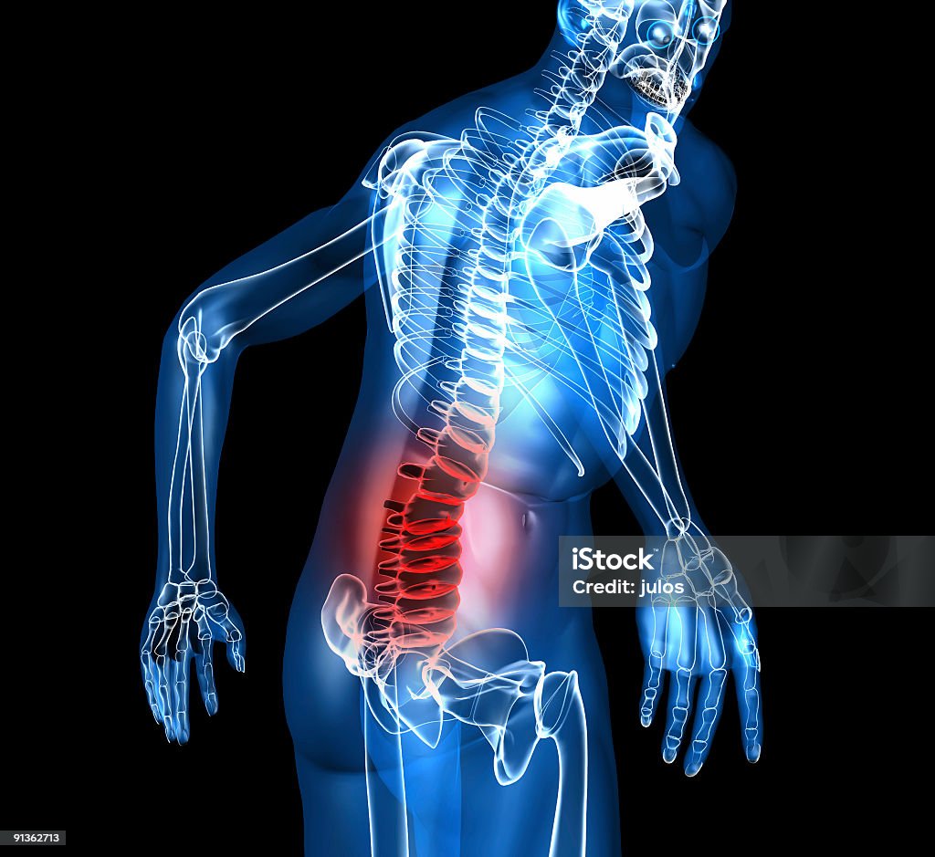 A skeleton depiction with back pain [url=/my_lightbox_contents.php?id=7697794][img]http://i205.photobucket.com/albums/bb214/julos1973/isotck%20jpgs/istock-3dchar.jpg[/img][/url]

[url=/my_lightbox_contents.php?id=7298942][img]http://i205.photobucket.com/albums/bb214/julos1973/isotck%20jpgs/istock-new.jpg[/img][/url]

[url=/my_lightbox_contents.php?id=5827533][img]http://i205.photobucket.com/albums/bb214/julos1973/isotck%20jpgs/istock-best.jpg[/img][/url]

[url=/my_lightbox_contents.php?id=2292256][img]http://i205.photobucket.com/albums/bb214/julos1973/isotck%20jpgs/istock-frogs.jpg[/img][/url]

[url=/my_lightbox_contents.php?id=2118388][img]http://i205.photobucket.com/albums/bb214/julos1973/isotck%20jpgs/istock-bus.jpg[/img][/url]

[url=/my_lightbox_contents.php?id=6279483][img]http://i205.photobucket.com/albums/bb214/julos1973/isotck%20jpgs/istock-robots.jpg[/img][/url] Pain Stock Photo