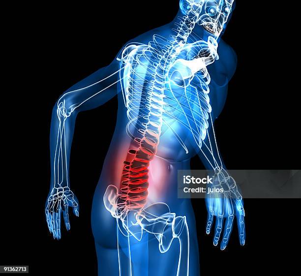 A Skeleton Depiction With Back Pain Stock Photo - Download Image Now - Pain, Back, Concentric